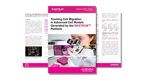 Tracking cell migration in advanced cell models generated by the RASTRUM™ Platform
